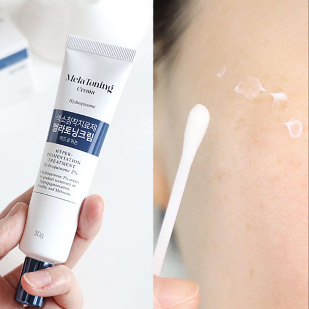 DONG-A Mela Toning Cream 30g Spots, Freckles, Senile Dark Spots, Melanin Pigmentation, Acne Area, from Korea