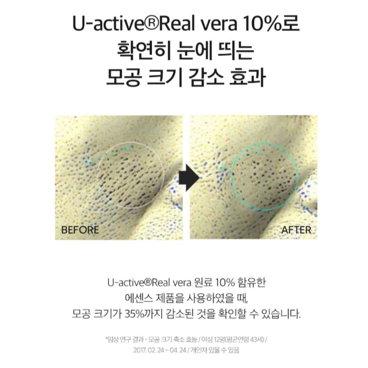 Derma Factory Real Vera Pore Serum 30ml Bifida Fermented Niacinamide Adenosine Elasticity Brightening / from Seoul, Korea